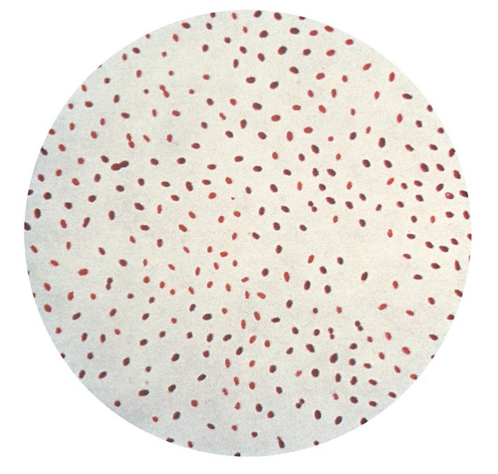 IVD4RND Image