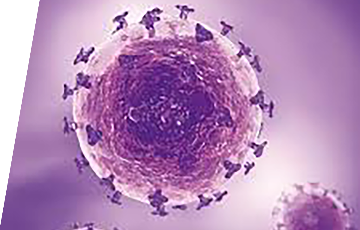 Varicella zoster virus (VZV) - IVD ELISA kits for research