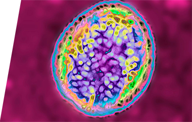 Brucella - IVD ELISA kits for research