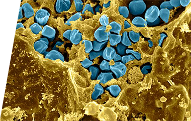 Candida - IVD ELISA kits for research